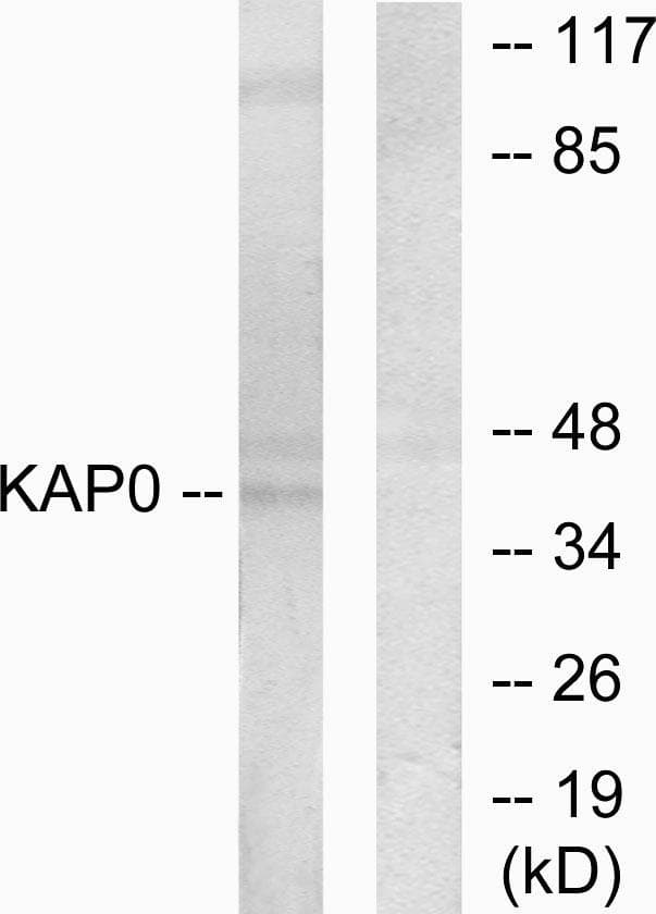 PRKAR1A Antibody
