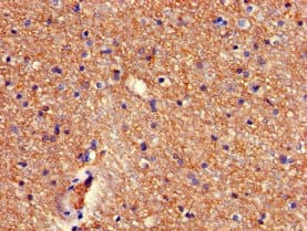 Polyclonal Rabbit anti-Human RBM38 Antibody (IHC, IF)