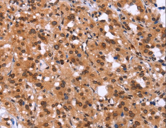 ADGRA2 / GPR124 Antibody