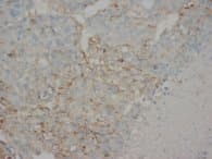 Alpha-Fetoprotein Antibody (clone AP-1, Sepharose)