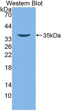 DEFB4A / BD-2 Antibody (aa24-64)