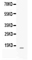 MGP / Matrix Gla-Protein Antibody