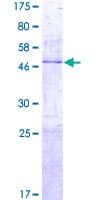 Human PTRH1 Protein (Recombinant GST)
