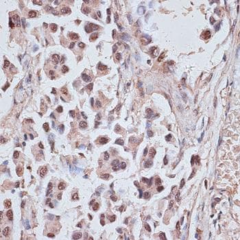 NR5A2 / LRH-1 Antibody