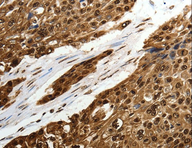 Polyclonal Rabbit anti-Human SCN1A / Nav1.1 Antibody (IHC)