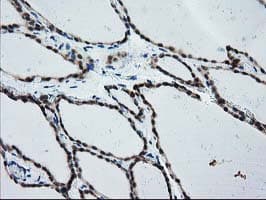 IHC-plus™ CYP1A2 Antibody (clone 2C6)