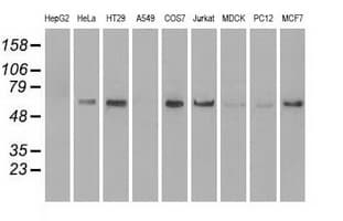 Monoclonal Mouse anti-Human NRBP1 / NRBP Antibody (clone OTI7E2, IHC, WB)