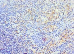 TFPI2 Antibody (aa23-235)