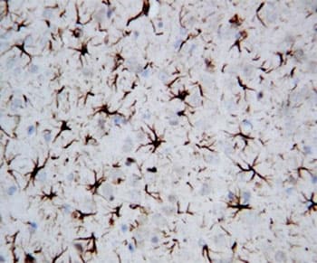 GFAP Antibody (aa417-432)