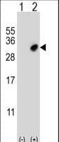 Polyclonal Rabbit anti-Human GSTO2 Antibody (aa82-110, IF, WB)