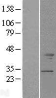 TMOD2 / Tropomodulin 2 Protein (Over-Expression Lysate Myc-DDK (Flag))