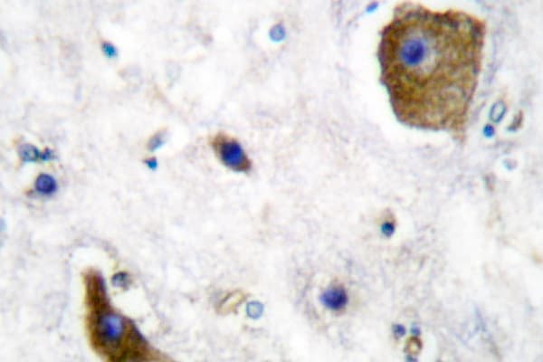 GAD1 / GAD67 Antibody (Ala492)