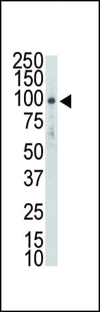 Polyclonal Rabbit anti-Human DDR2 Antibody (aa290-320, WB)