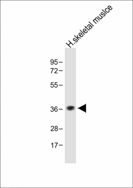 T2R5 / TAS2R5 Antibody (Internal)