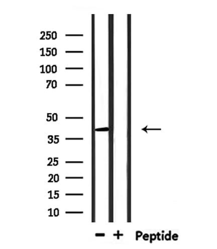 RNF167 Antibody