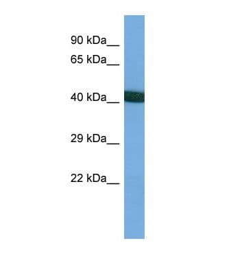 BECN1 / Beclin-1 Antibody (aa45-94)