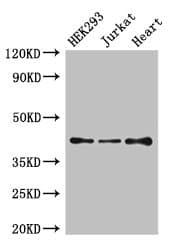 S1PR5 / EDG8 / S1P5 Antibody