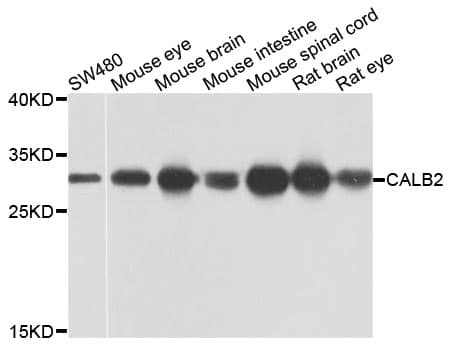 PathPlus™ CALB2 / Calretinin Antibody