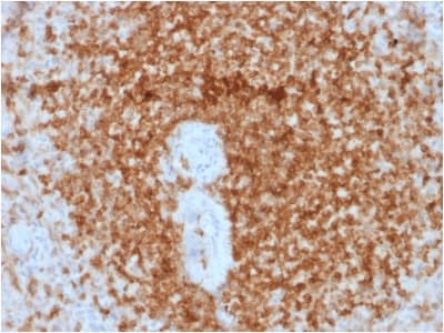 BCL2 / Bcl-2 Antibody (clone rBCL2/796, Azide-free, Carrier-free)