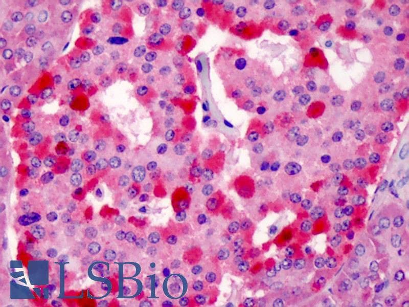 IHC-plus™ STRADB / ALS2CR2 Antibody
