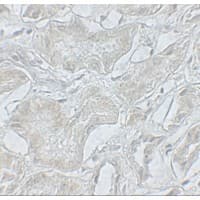 ARF6 Antibody