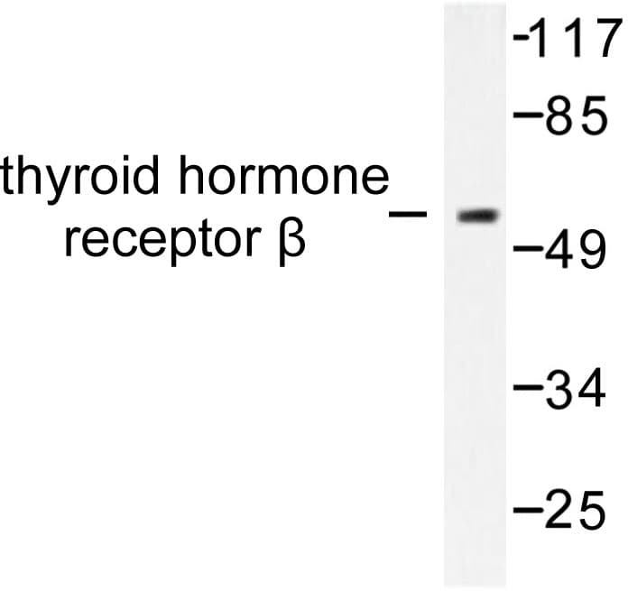 NR1A2 / THRB Antibody (Leu37)
