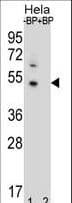 DNAJB6 Antibody (aa218-247)