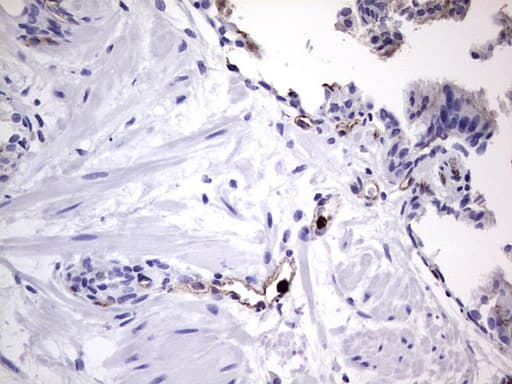 Monoclonal Mouse anti-Human CEACAM5 / CD66e Antibody (clone OTI3D8, aa35-680, IHC, WB)