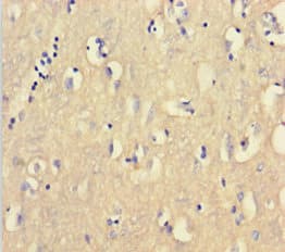 Polyclonal Rabbit anti-Human CNBP / ZNF9 Antibody (aa2-170)