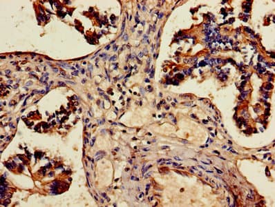 ALDH3A1 Antibody