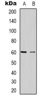 CABLES2 Antibody (Internal)