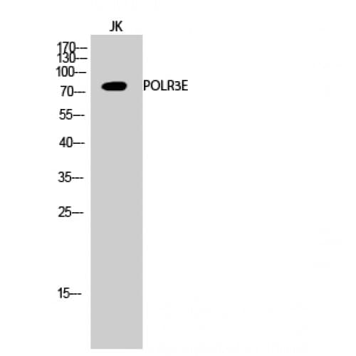 Polyclonal Rabbit anti-Human POLR3E / SIN Antibody (160-240 aa, Internal, IHC, IF, WB)