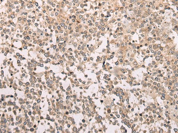 M1AP Antibody