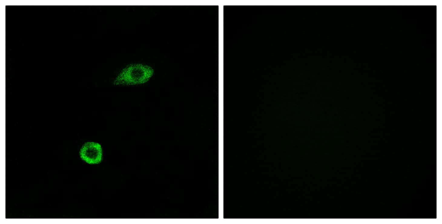 OR1B1 Antibody (aa161-210)