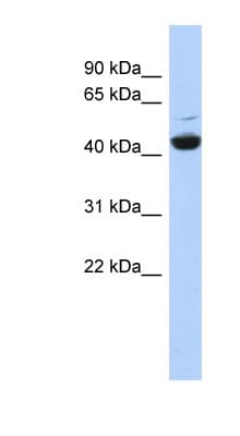 ATP6V1C1 Antibody (aa61-110)