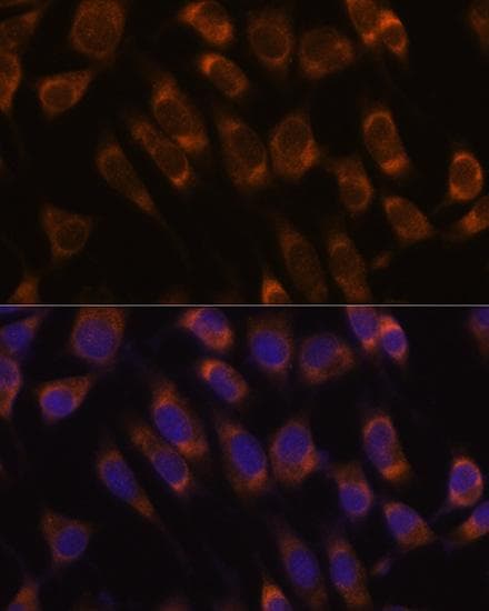 Polyclonal Rabbit anti-Human SEC61B Antibody (IF, WB)