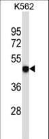 P2RX5 / P2X5 Antibody (aa325-353)