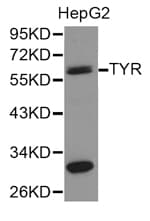 Polyclonal Rabbit anti-Human Tyrosinase Antibody (IHC, WB)