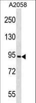 Polyclonal Rabbit anti-Human PROX1 Antibody (aa492-522, IHC, IF, WB)