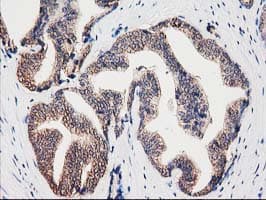 CLPP Antibody (clone OTI1E2, Carrier-free)
