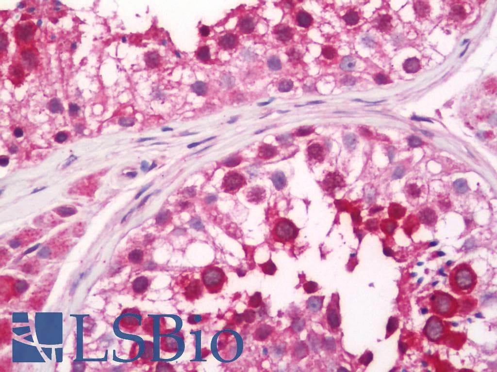 IHC-plus™ Polyclonal Rabbit anti-Human GSE1 / KIAA0182 Antibody (aa463-636, IHC, WB)