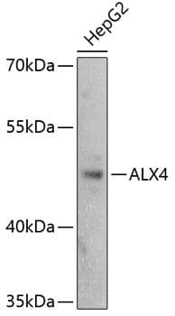 Polyclonal Rabbit anti-Human ALX4 Antibody (WB)