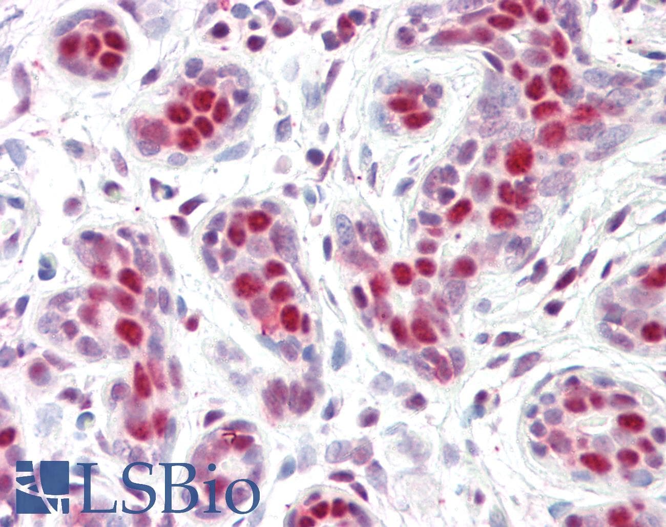 IHC-plus™ Polyclonal Goat anti-Human ANP32B Antibody (aa239-251, IHC, WB)
