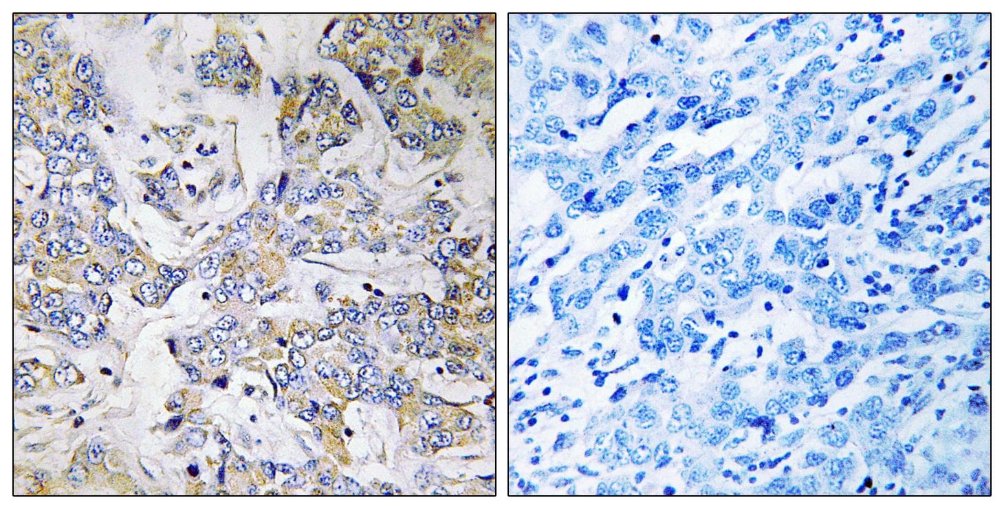 RPL37 / Ribosomal Protein L37 Antibody