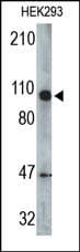 Polyclonal Rabbit anti-Human CYLD Antibody (WB)