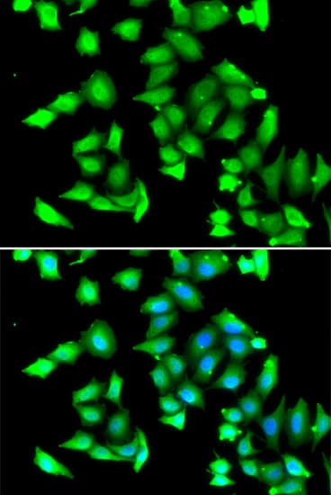 Polyclonal Rabbit anti-Human GSTCD Antibody (IHC, IF, WB)