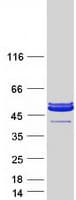 Human PARVA Protein (Recombinant Myc-DDK (Flag))