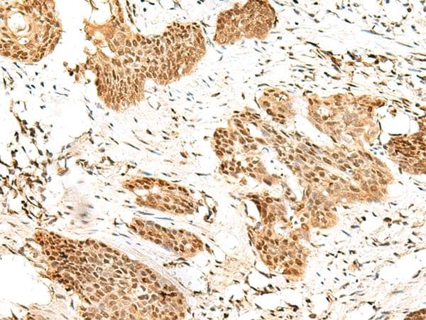 RBM19 Antibody