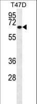MMP2 Antibody