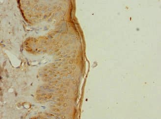 CFAP20 / GTL3 Antibody